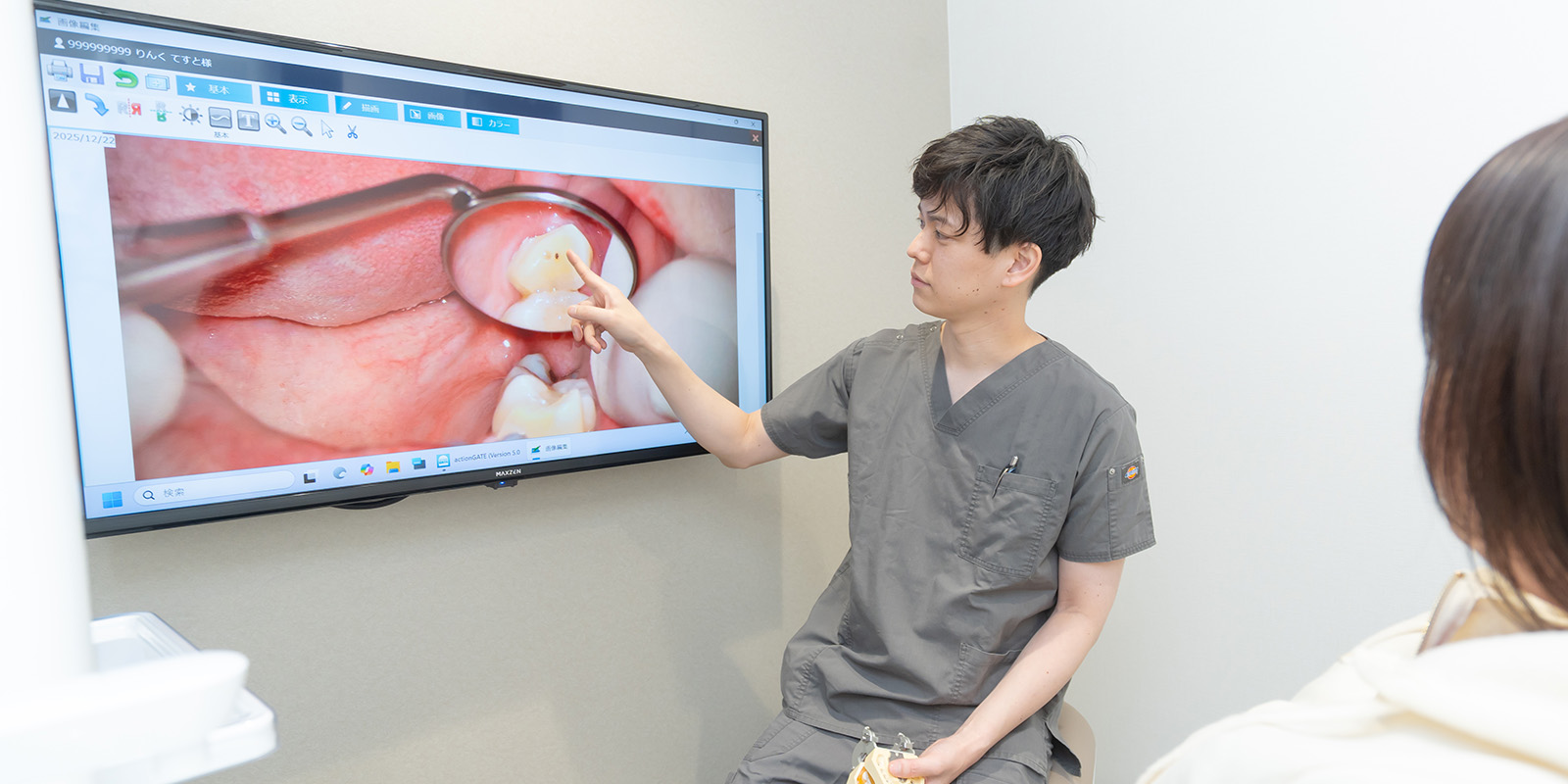 むし歯の治療方針