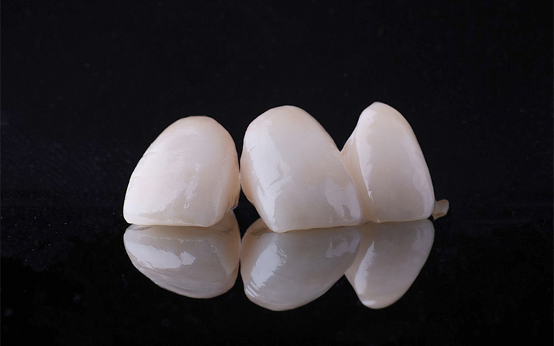 ジルコニアボンド