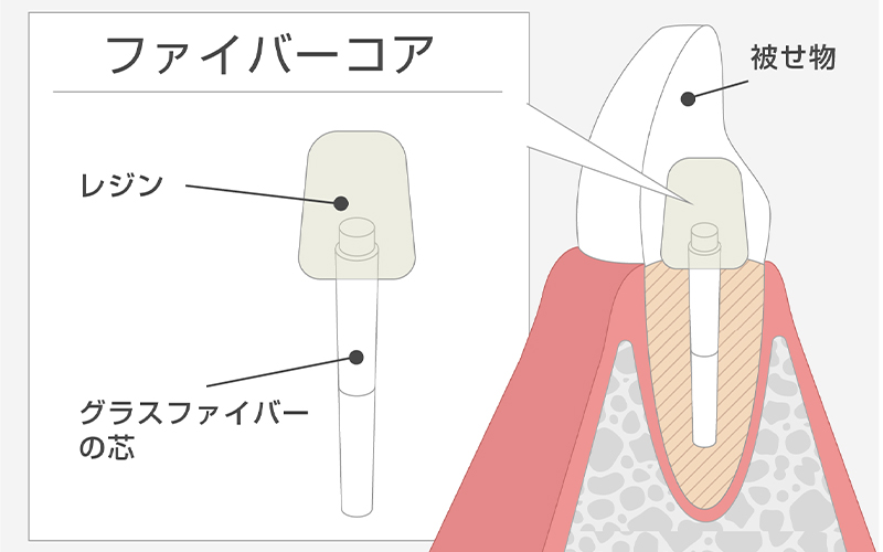 ファイバーコア