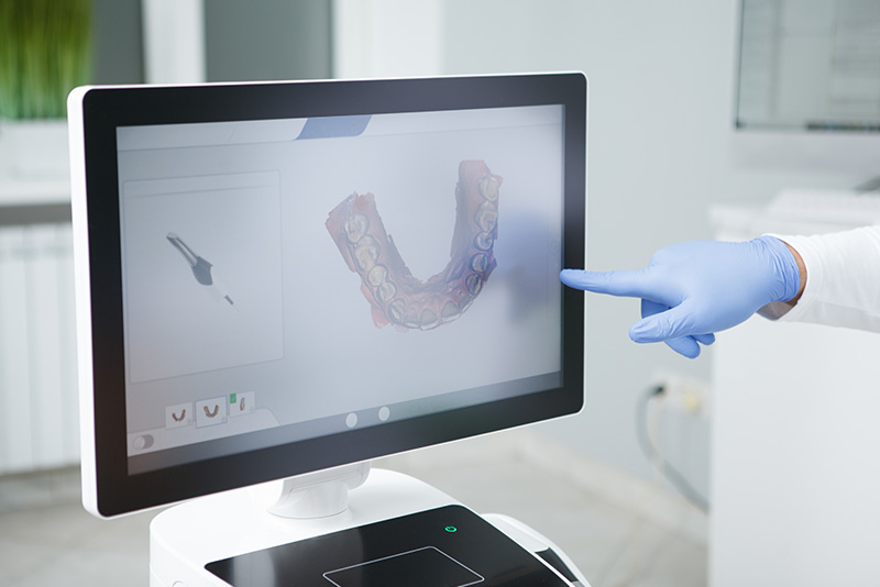 コンピューターシミュレーションによる精密な計画