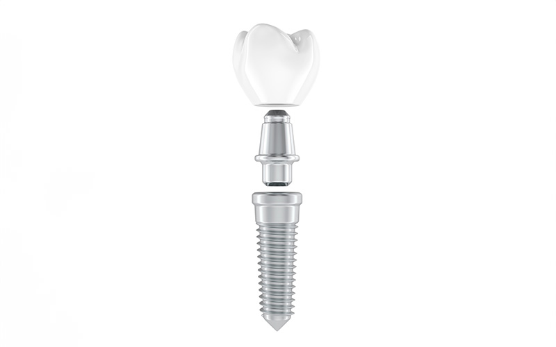 骨造成が不要なショートインプラント