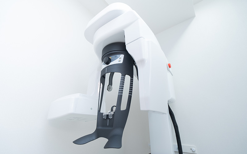 インプラント治療について