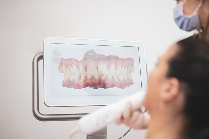 負担の少ない精密な型取り