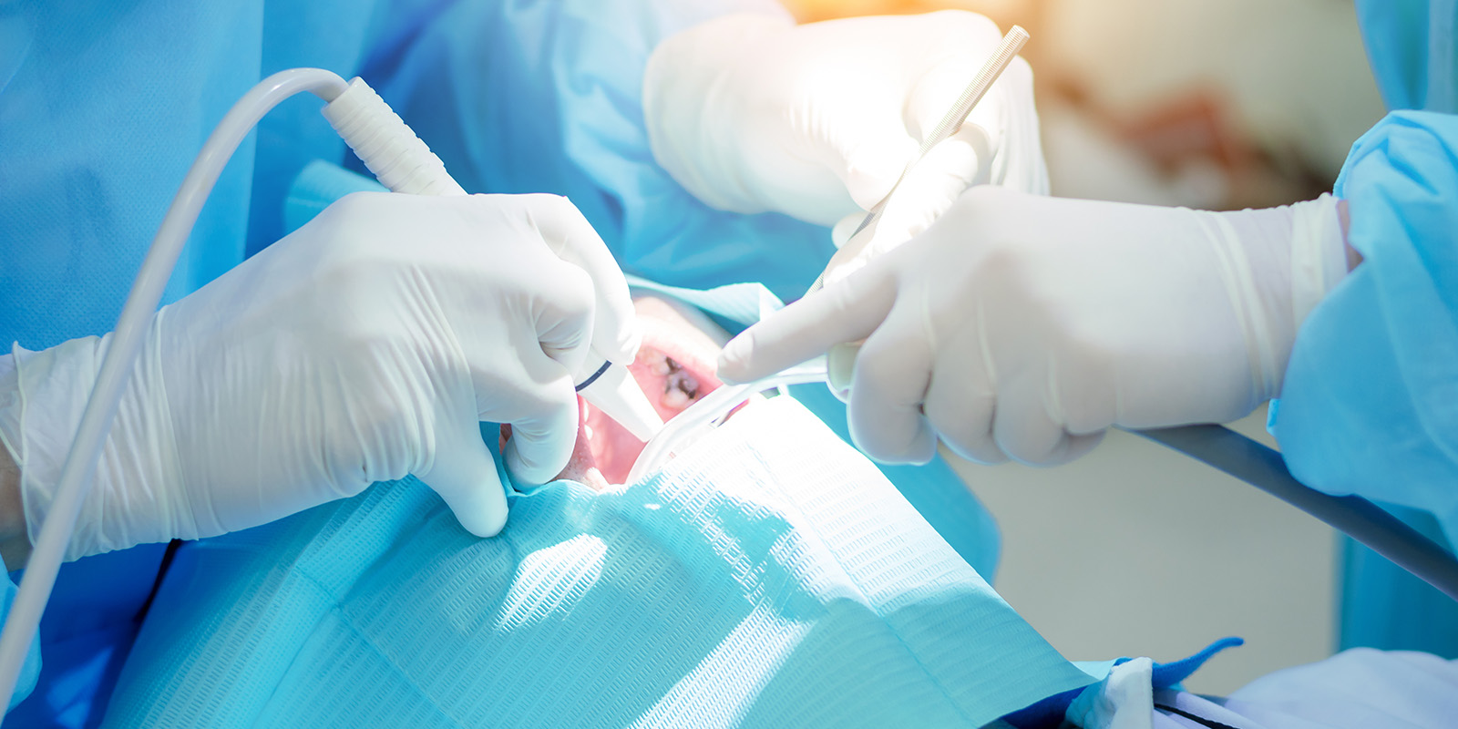 むし歯の治療方針